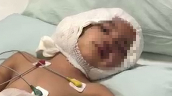 Pitbull saldırısına uğrayan Asiye'nin doktoru: 7-10 günlük süreç çok kritik